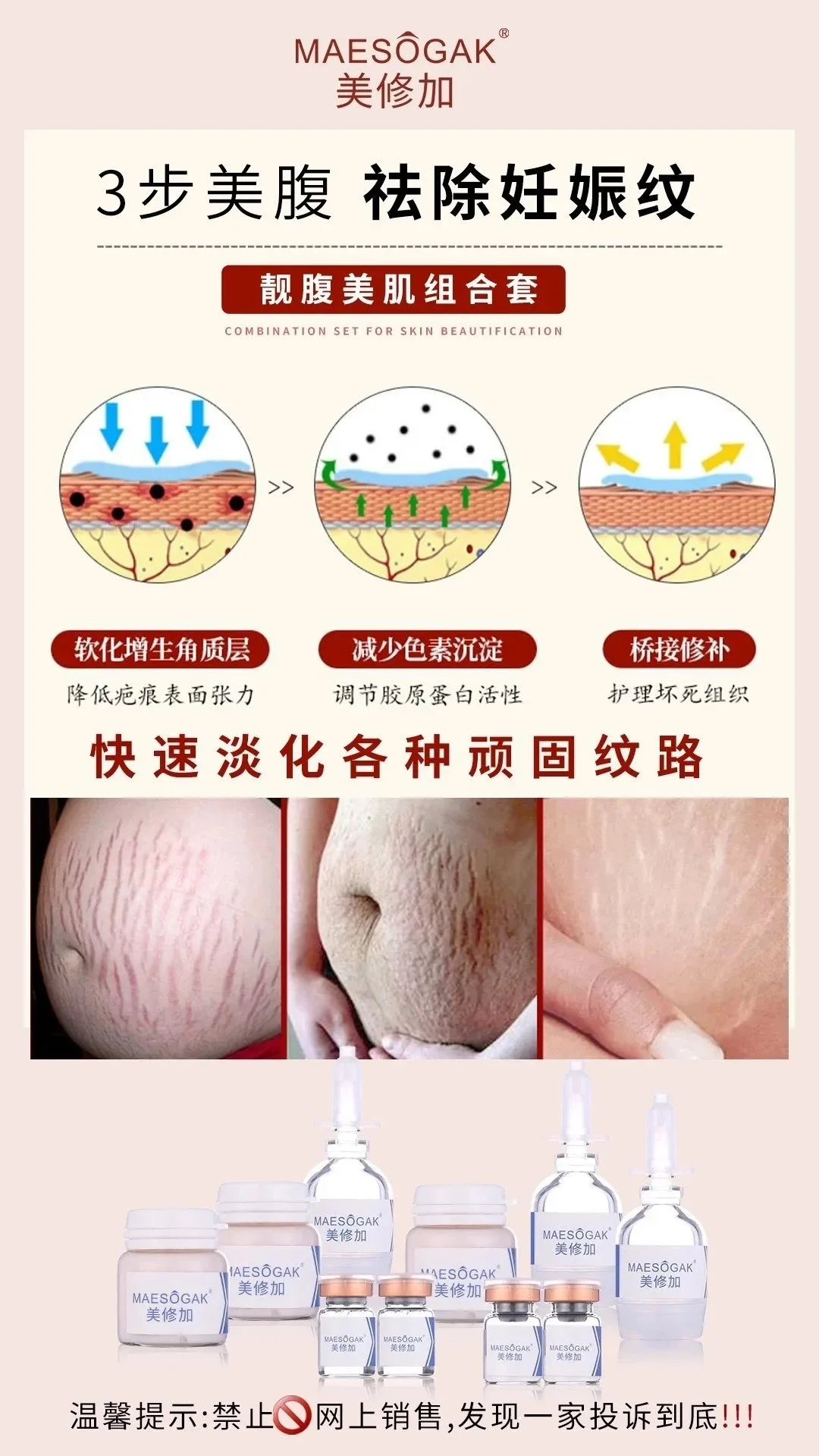 美修加靓腹美肌组合套，妊娠纹套盒，重1.1Kg，（2028年1月14号，18套/件 图片 7