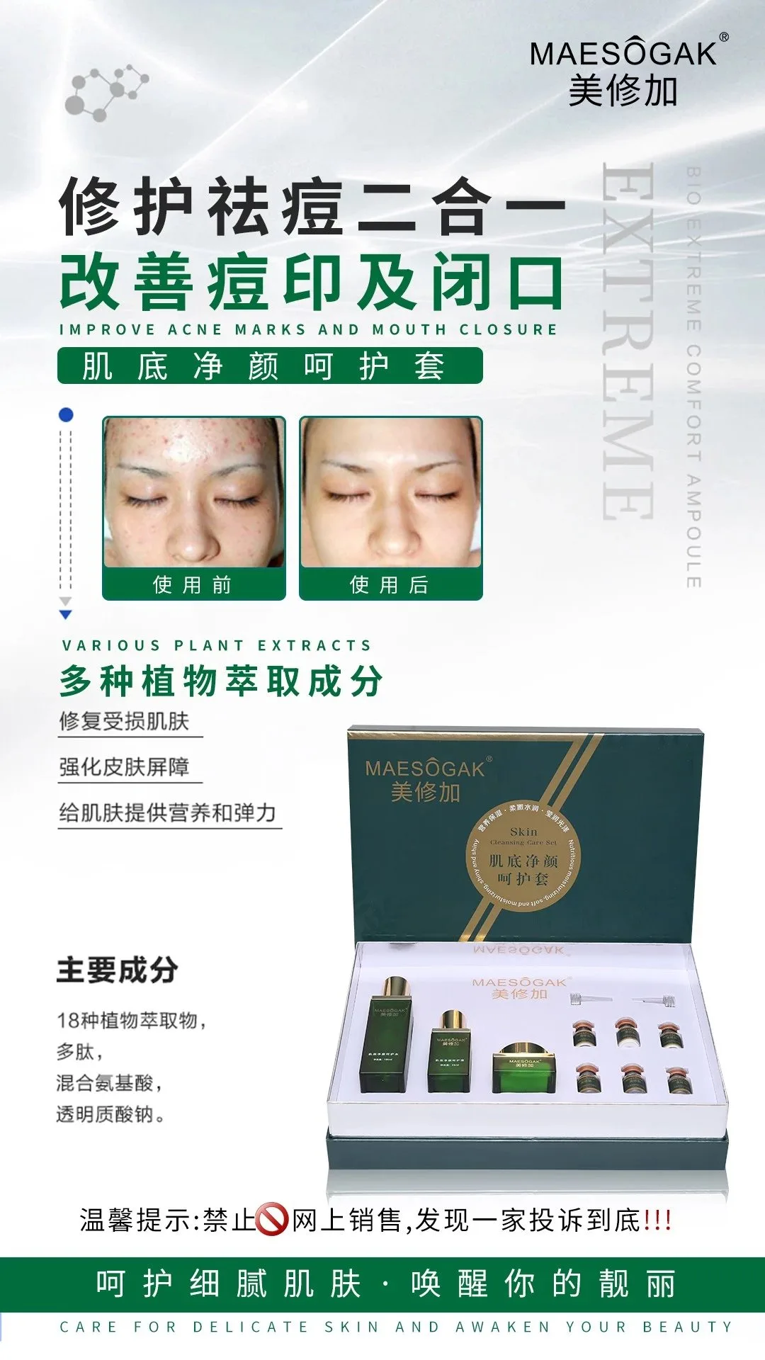 美修加肌底净颜呵护套，祛痘套盒，家居4件套，14套/件，1.5公斤，保质期:2029年2月28，家居护肤套盒 图片 2