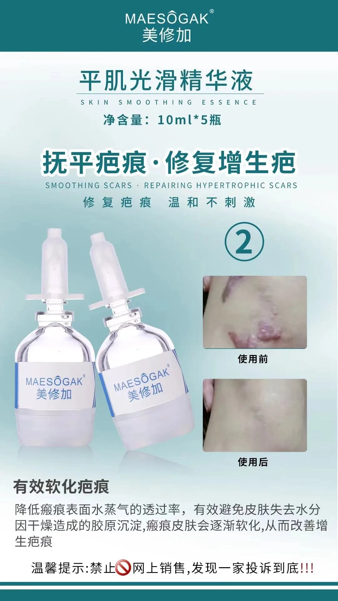 美修加【平肌光滑组合套】凸疤增生疤套盒，保质期2029年2月27日 图片 8