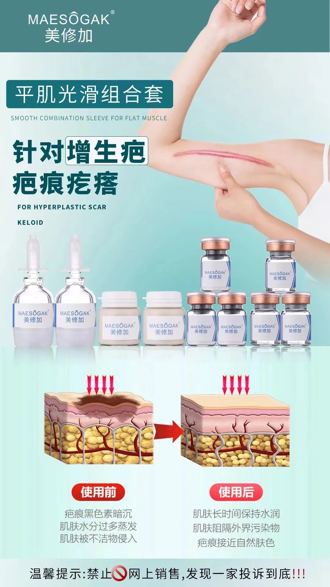 美修加【平肌光滑组合套】凸疤增生疤套盒，保质期2029年2月27日 图片 6