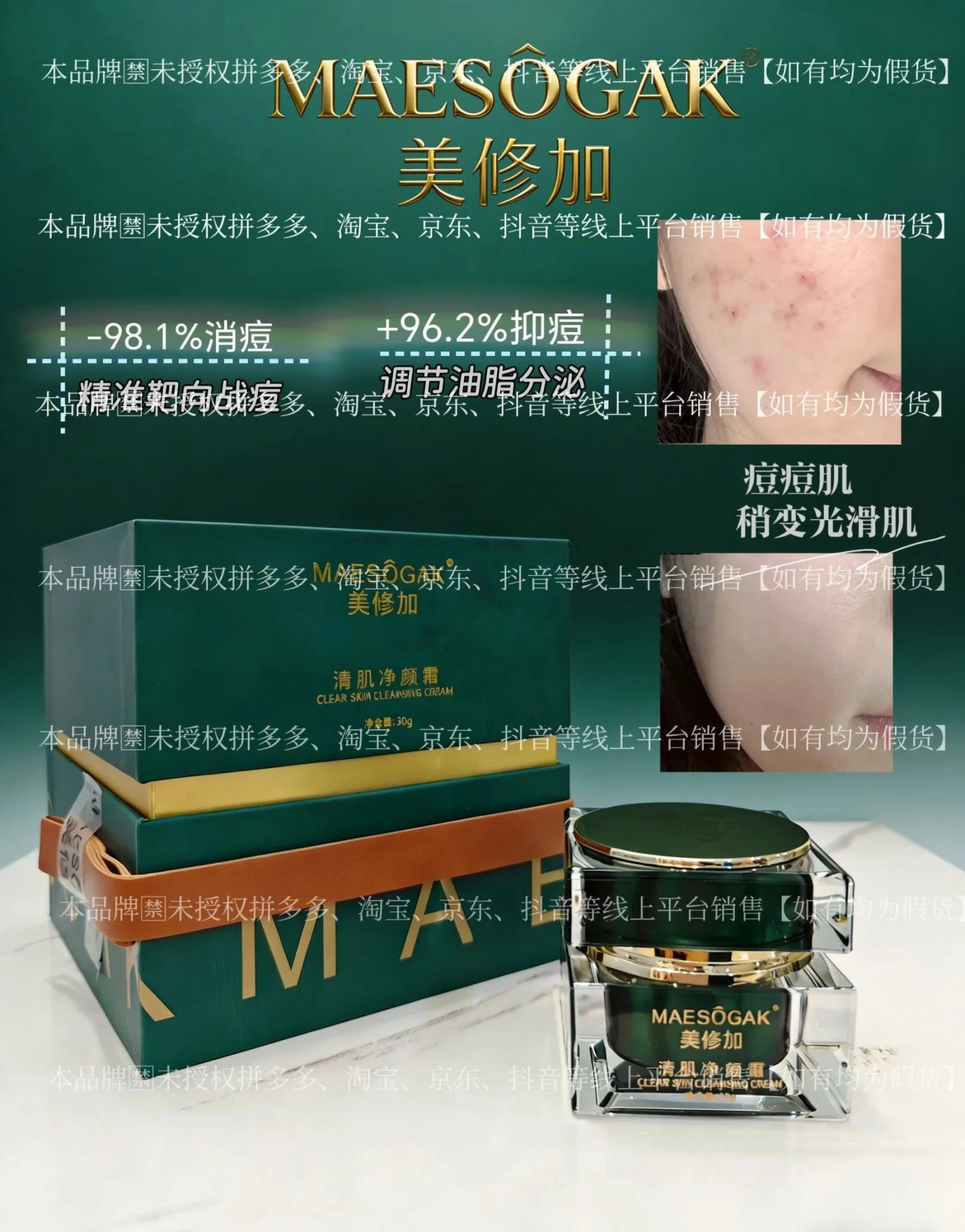 ②美修加清肌净颜霜（3天祛痘），净含量30g，产品重0.38Kg，保质期2029年1月13日 图片 2