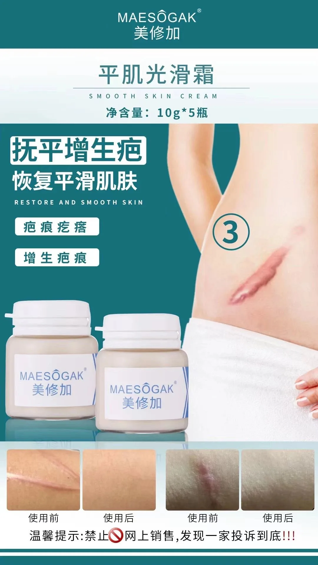 美修加【平肌光滑组合套】凸疤增生疤套盒，保质期2029年2月27日 图片 9