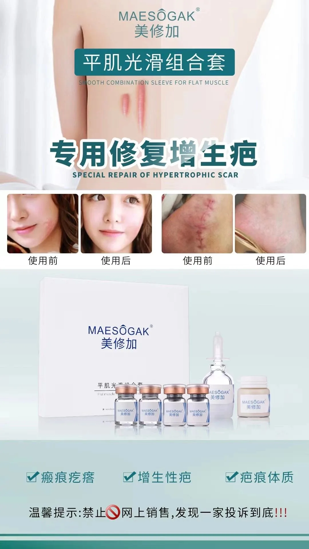 美修加【平肌光滑组合套】凸疤增生疤套盒，保质期2029年2月27日 图片 3