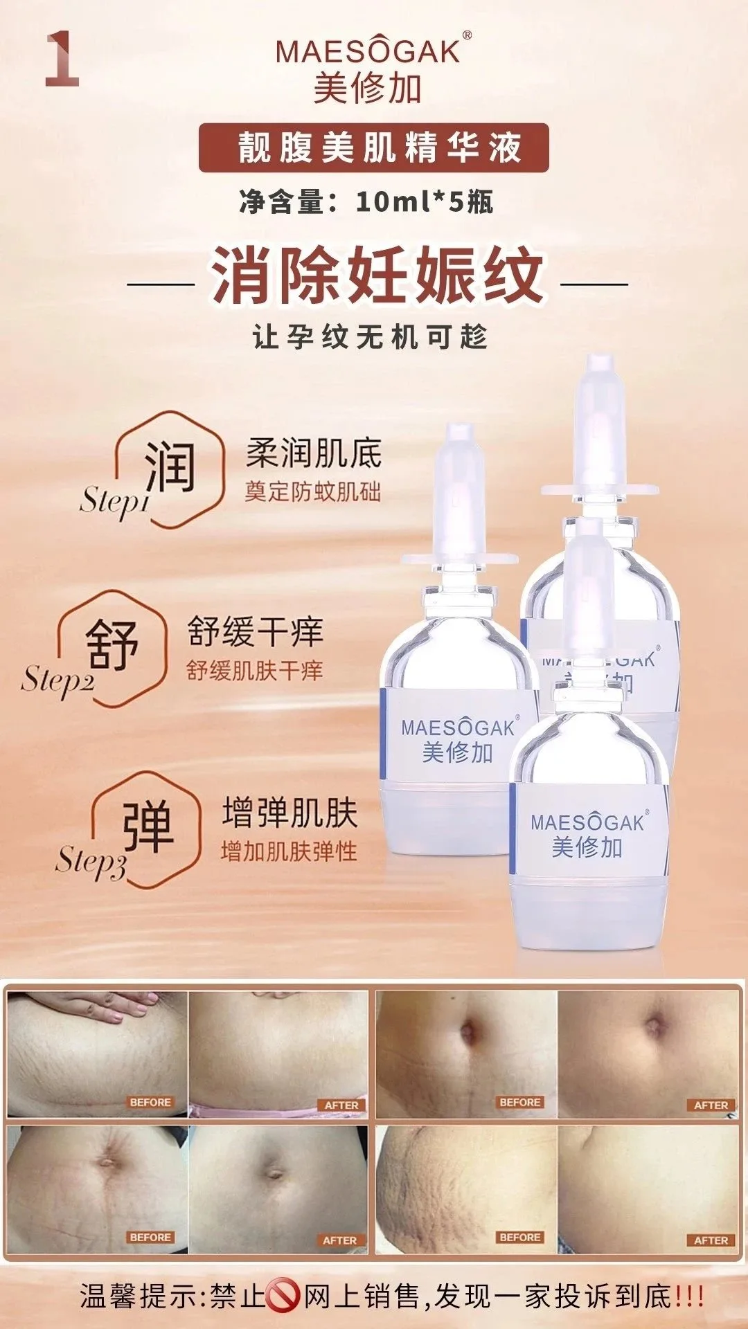 美修加靓腹美肌组合套，妊娠纹套盒，重1.1Kg，（2028年1月14号，18套/件 图片 3
