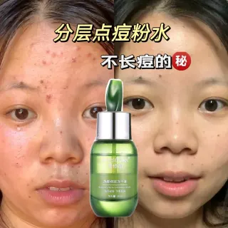 美修加净颜修肤冻干液，点痘水祛痘水，30毫升/瓶，产品重:150克重、保质期:2029年4月17日